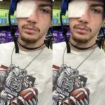 Young Georgia Father Rebuilding His Life After Surviving Devastating Head Gunshot Wound